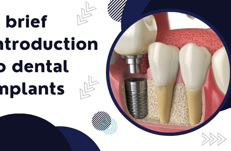 A Brief Introduction To Dental Implants