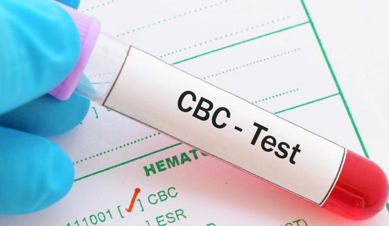 Complete Blood Count (CBC) – Everything You Should Know About It